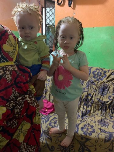 Cute-toddlers-living-with-albinism-in-Douala-Cameroon
