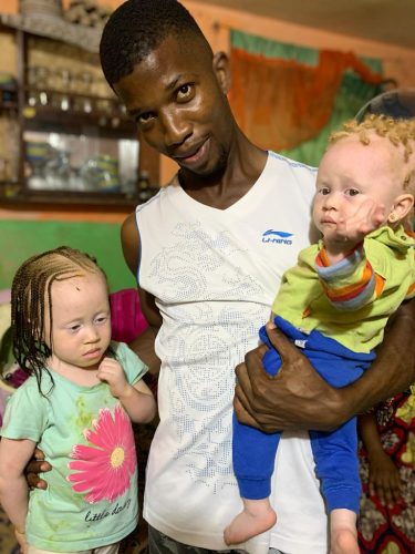 Marcello-a-MW-volunteer-and-two-children-with-albinism-in-Douala