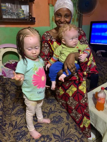 Proud-mom-of-two-children-with-albinism-in-Douala-Cameroon