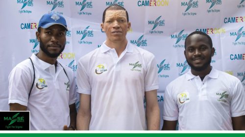 2025-international-Albinism-Day-in-Cameroon-