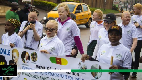2025-international-Albinism-Day-in-Cameroon-1