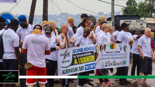 2025-international-Albinism-Day-in-Cameroon-12