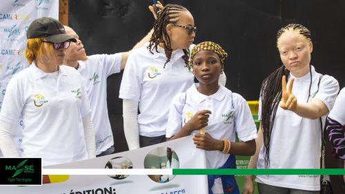 2025-international-Albinism-Day-in-Cameroon-13