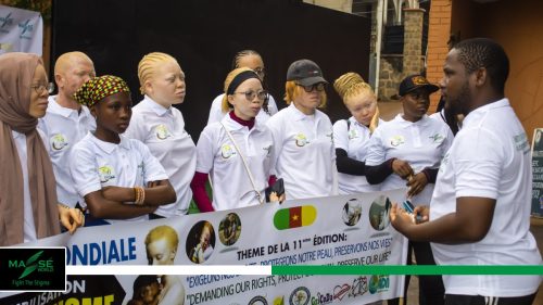 2025-international-Albinism-Day-in-Cameroon-14