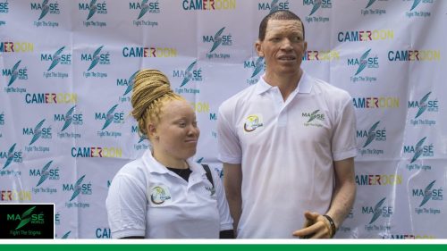 2025-international-Albinism-Day-in-Cameroon-15