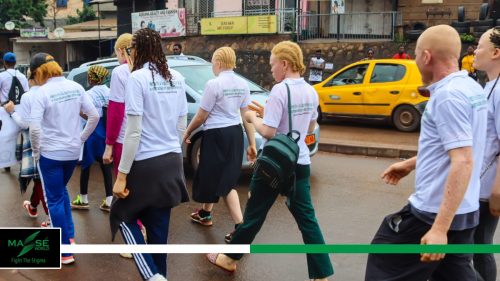 2025-international-Albinism-Day-in-Cameroon-18