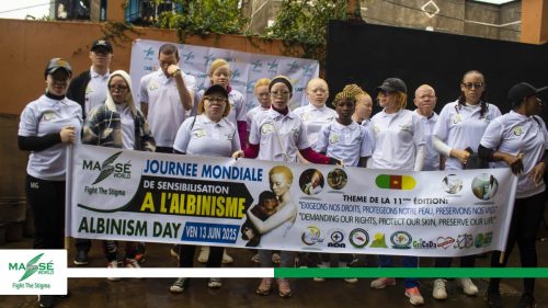 2025-international-Albinism-Day-in-Cameroon-24