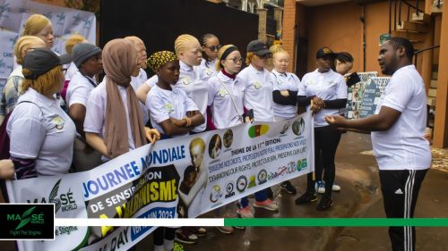 2025-international-Albinism-Day-in-Cameroon-27