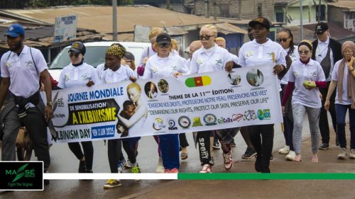 2025-international-Albinism-Day-in-Cameroon-29