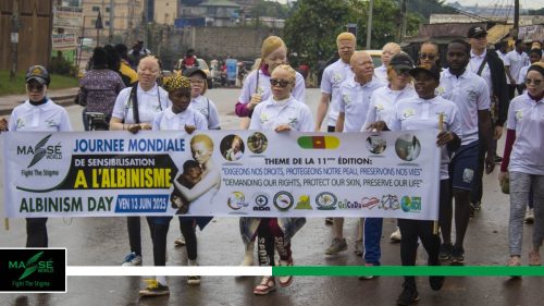 2025-international-Albinism-Day-in-Cameroon-30