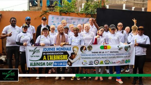 2025-international-Albinism-Day-in-Cameroon-31