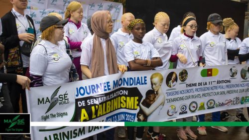 2025-international-Albinism-Day-in-Cameroon-32