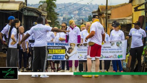 2025-international-Albinism-Day-in-Cameroon-33