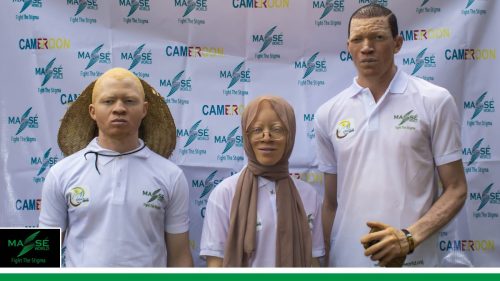 2025-international-Albinism-Day-in-Cameroon-36
