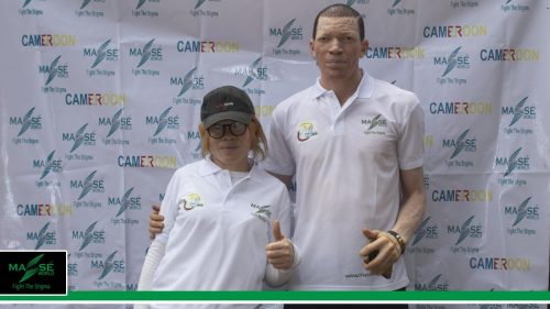 2025-international-Albinism-Day-in-Cameroon-37