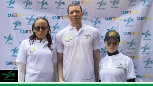 2025-international-Albinism-Day-in-Cameroon-5