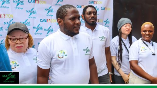 2025-international-Albinism-Day-in-Cameroon-6