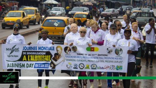 2025-international-Albinism-Day-in-Cameroon-7