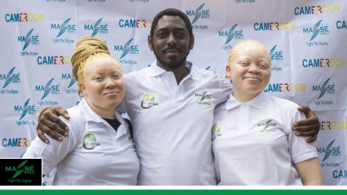 2025-international-Albinism-Day-in-Cameroon-9