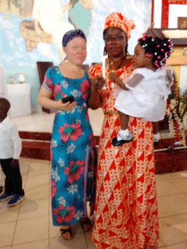 An auntie with albinism at a party in Cameroon