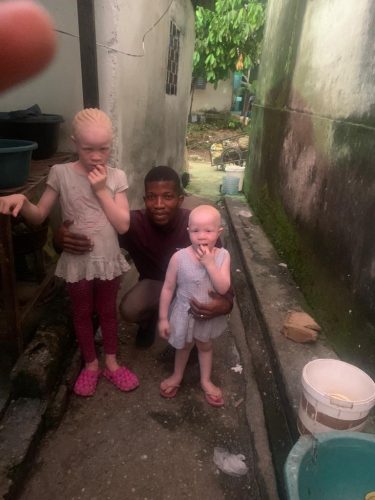 Big sister and little sister living with albinism in Douala